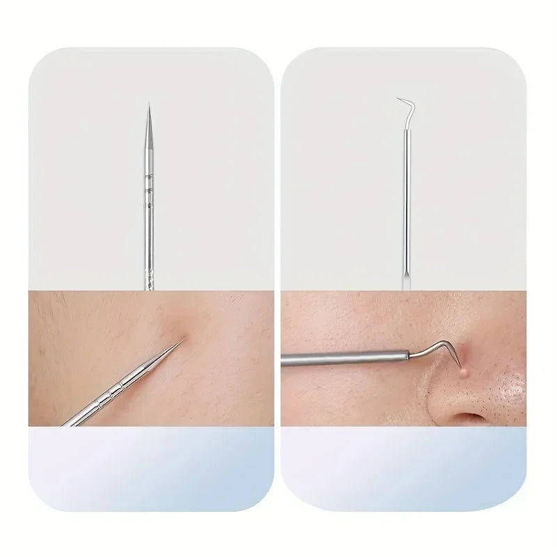 Stainless Steel Skin Care Tool Set – Blackhead & Pimple Remover Kit (4, 7 or 8 Piece)