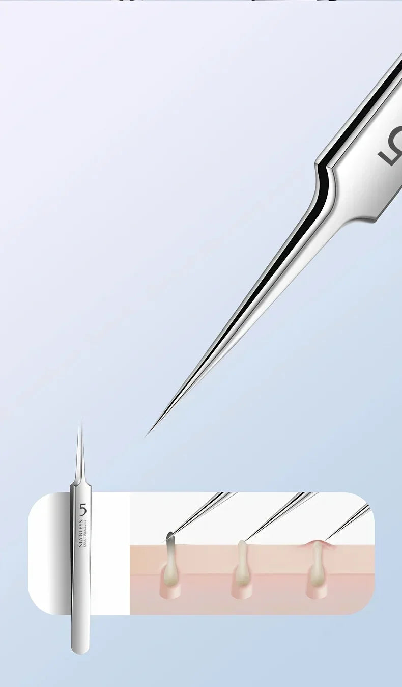 Blackhead Remover Tool Set – Stainless