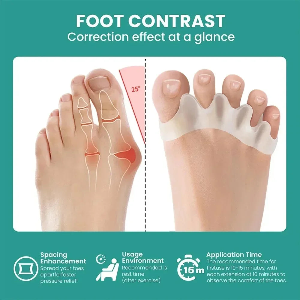 Soft Silicone Toe Separators – Gel Toe Spacers for Foot Relief
