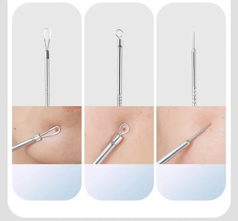 Stainless Steel Skin Care Tool Set – Blackhead & Pimple Remover Kit (4, 7 or 8 Piece)