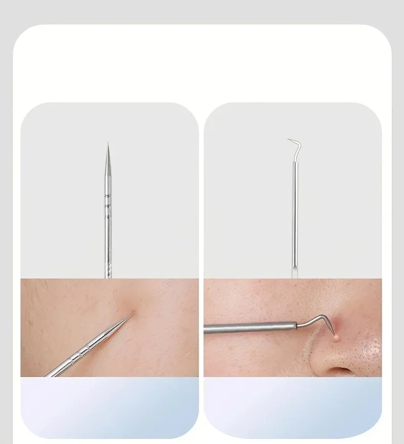 Blackhead Remover Tool Set – Stainless