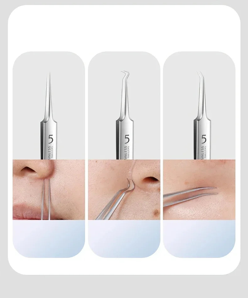 Blackhead Remover Tool Set – Stainless